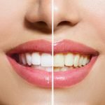 teeth
